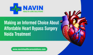 Making an Informed Choice About Affordable Heart Bypass Surgery Noida Treatment